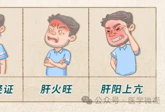 一过年就上火 这一常见物可让你摆脱上火烦恼