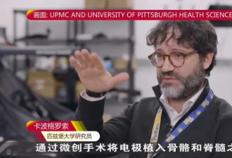 美研究:植入电极能改善脊髓性肌肉萎缩症患者病情