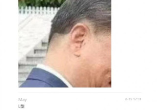传习过年“二次脑梗” 疑似在协和“帅府”治疗