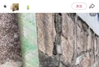 小孩被“隐形杀手”玻璃纤维扎伤，医院无法全部取出