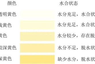这3类人，不建议喝太多水