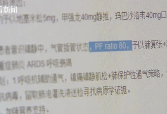 六旬爷叔出境游染流感未及时就医,送ICU抢救一月