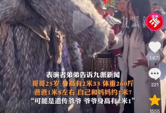 万岁山景区回应巨人演员走红，医生：早发现早治疗