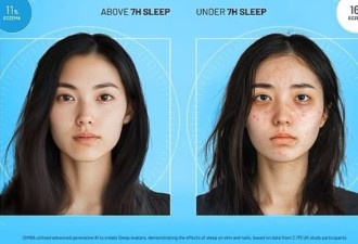 睡不够7小时有多伤？对比图像很“恐怖”