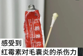 几乎家家都有！这种万能小药膏 危害大