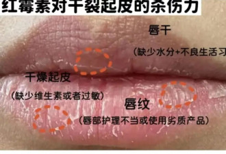几乎家家都有！这种万能小药膏 危害大