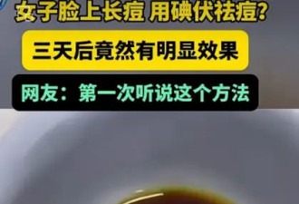 能祛痘、美白、治脱发、去脚气……碘伏真有这么神？医生提醒——