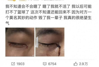 郭艾伦：可能毁了我一辈子