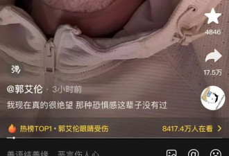 太恐怖了，郭艾伦眼睛缝了40多针：以后估计会瞎了