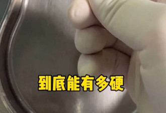 高油高盐的血管长这样,很多人看完不敢乱吃了