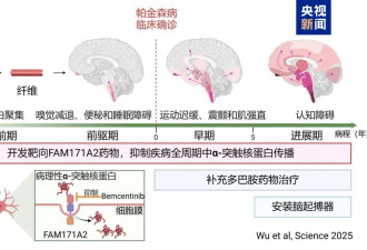 全球首次!复旦科研团队发现帕金森病全新治疗靶点