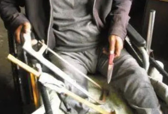 河北硬汉郑艳良自行锯掉右腿，结局怎样