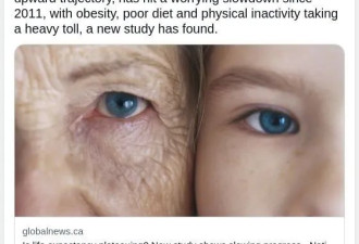 人类预期寿命放缓 加拿大人的两大死因