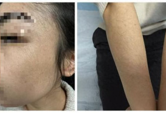 女子喷生发神器后 “毛手毛脚”吓坏同事