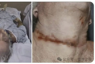 静待大瓜：爱泼斯坦萝莉岛档案就要公开了