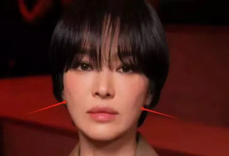 宋慧乔生图脸崩了？面中凹陷干瘪，苹果肌下垂明显