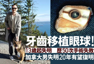 加男接受"牙齿植入眼睛"手术 失明20年或重见光明