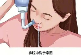 春季高发的过敏性鼻炎 到底怎么治？