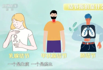 体检发现结节？多吃这几种天然“散结”食物