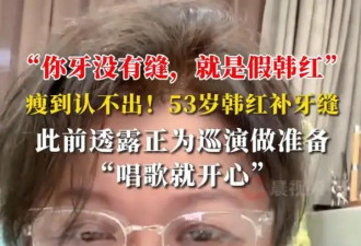 韩红分享补牙缝经历：补上豁了几十年的下牙缝，却特意保留上牙缝