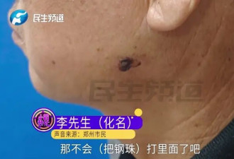 现实版“万磁王”？男子的脸竟能吸住磁铁！
