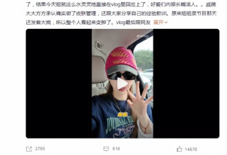 戚薇坦诚回应眼角上提：肉毒打多了！