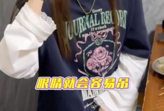 戚薇坦诚回应眼角上提：肉毒打多了！