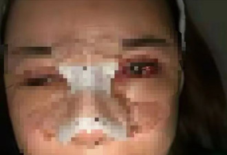 江苏女子“换马甲”开医美诊所非法行医 致两女伤残