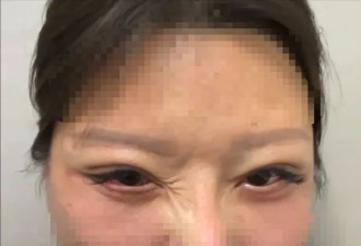 江苏女子“换马甲”开医美诊所非法行医 致两女伤残