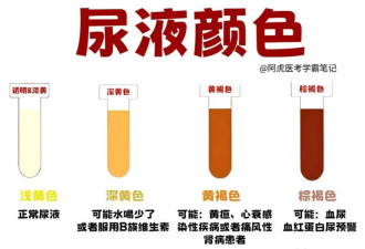 早晨第一泡尿,可能是身体在呼救!这些信号别忽略