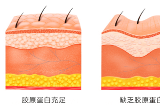 为什么你的胶原蛋白比别人流失得更快？