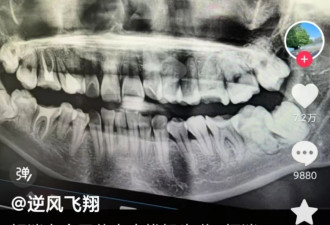 34岁女子疑被拔错牙 维权未果从医院坠亡 卫健委回应