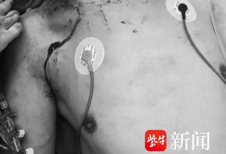 男子被水流刺穿颈部！失控的高压水枪，有多危险？