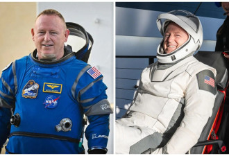 鸡腿症、婴儿脚...NASA太空人5后遗症难逆转