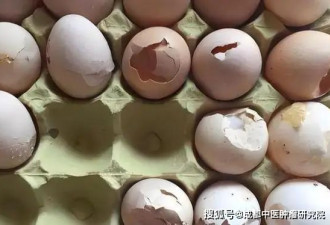 鸡蛋虽好 但这6种鸡蛋肿瘤患者最好别吃