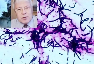 科学家给自己注射350万年前细菌 现况如何
