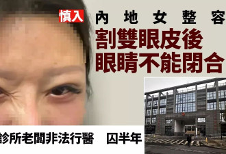 她割双眼皮后眼睛竟闭不起来 苏州医美诊所老板判监半年