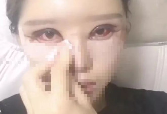 她割双眼皮后眼睛竟闭不起来 苏州医美诊所老板判监半年