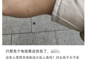 充电时突遭“枪击” 缝了8针..新能源车主注意了!