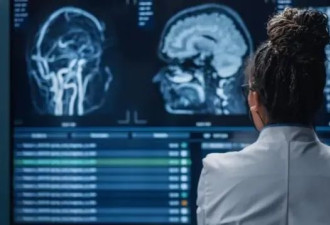 BBC：人类死亡时大脑会发生什么变化？
