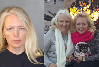 美7旬失智妇遭自养犬只咬死 女儿遭控过失杀人