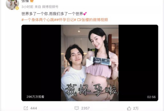 冲上热搜！张檬自曝孕35周臀位绕颈