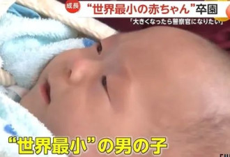 全球最轻男婴:出生仅半斤重 手掌大 已顽强长大