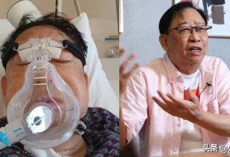 75岁老戏骨因流感进ICU，呼吸困难输两袋血，晚年潦倒靠资助度日