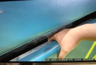 5岁女童游乐园里突然尖叫，头皮撕裂头骨露出