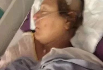 一次医疗事故 女子脑脊液外渗！24小时从眼鼻渗出 持续18年…