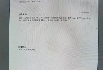江苏男塞黄瓜入肛门“治便秘” 网民都笑而不语