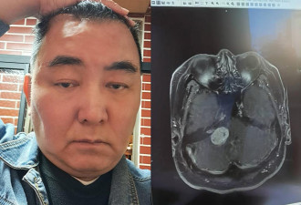 徐亨宣布离婚 净身出户 最新病况曝光