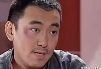 又一位58岁男星宣布离婚，曾投资失败，如今患脑肿瘤引发脑积水
