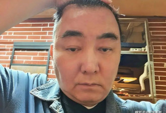 又一位58岁男星宣布离婚，曾投资失败，如今患脑肿瘤引发脑积水